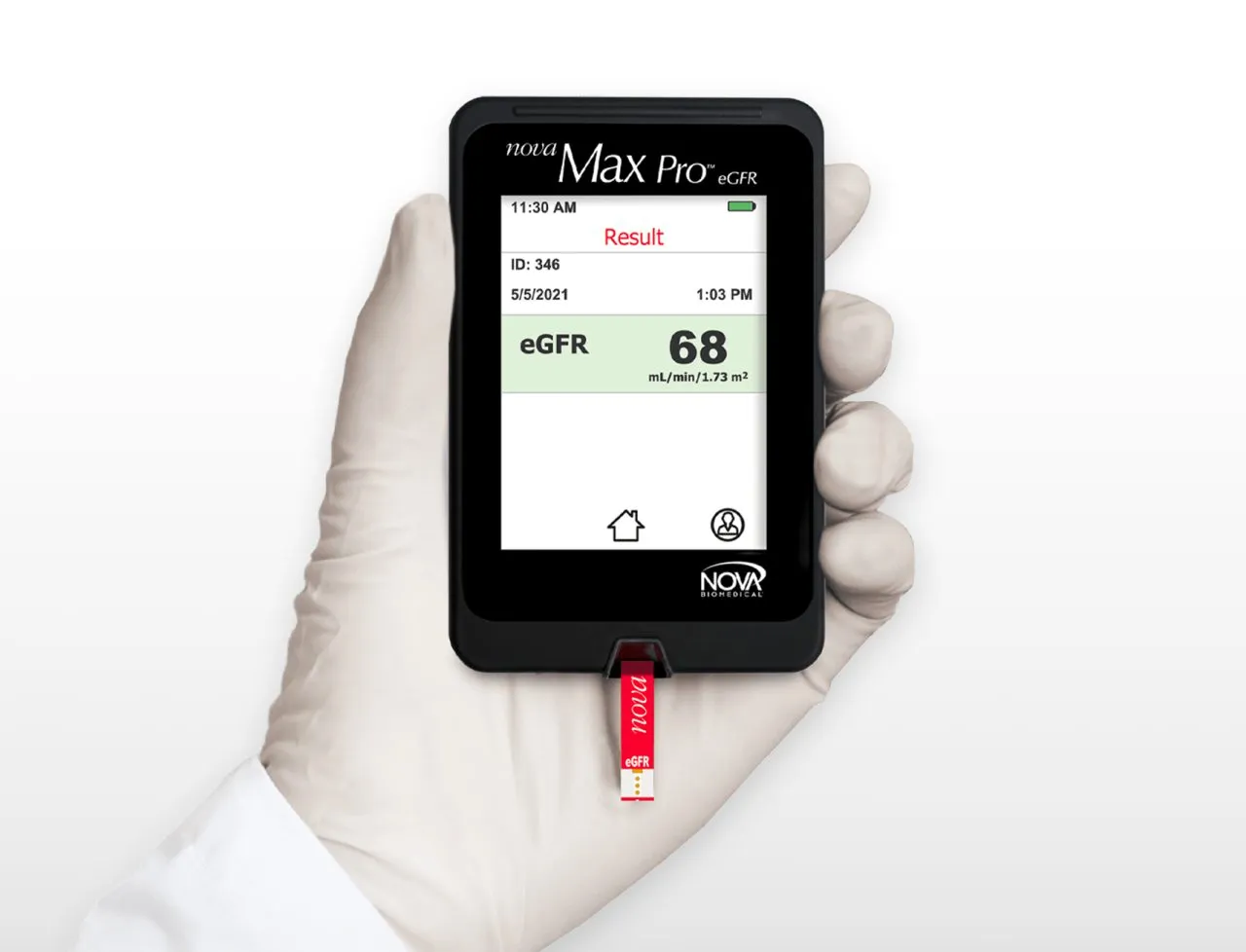 Nova Max Pro Creatinine/eGFR meter